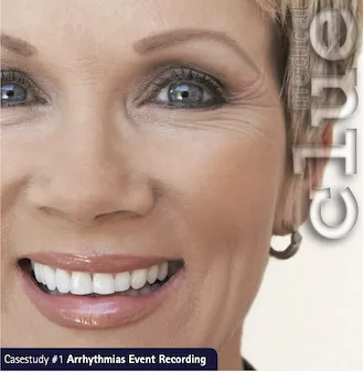 Diagnosis of Arrhythmia