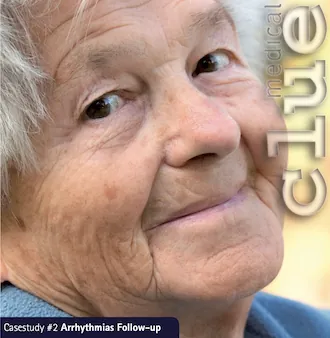 Monitoring in Arrhythmia