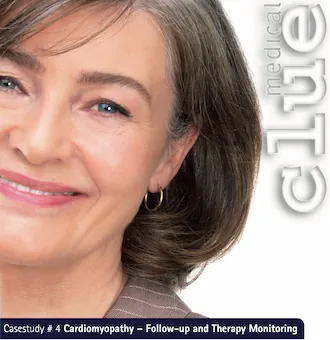 Therapy monitoring in Cardiomyopathy